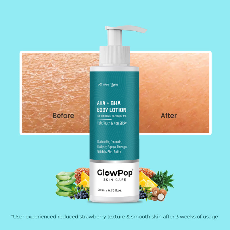 GlowPop 10% AHA + 1% BHA Body Lotion - Smooths Rough & Bumpy Skin - With Niacinamide  (200 ml)