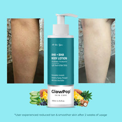 GlowPop 10% AHA + 1% BHA Body Lotion - Smooths Rough & Bumpy Skin - With Niacinamide  (200 ml)