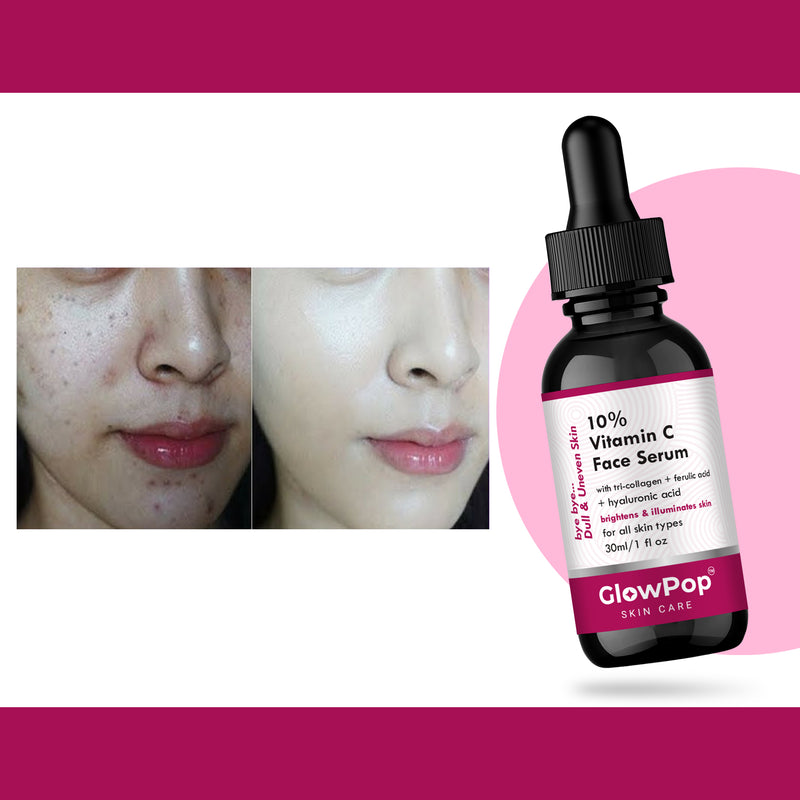 GlowPop 10% Vitamin C Serum for Skin Brightening, UV Damage & Glow (Stable) Men & Women  (30 ml)